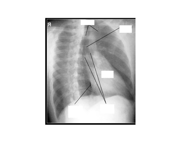 X-Ray Rib Labeling — Printable Worksheet
