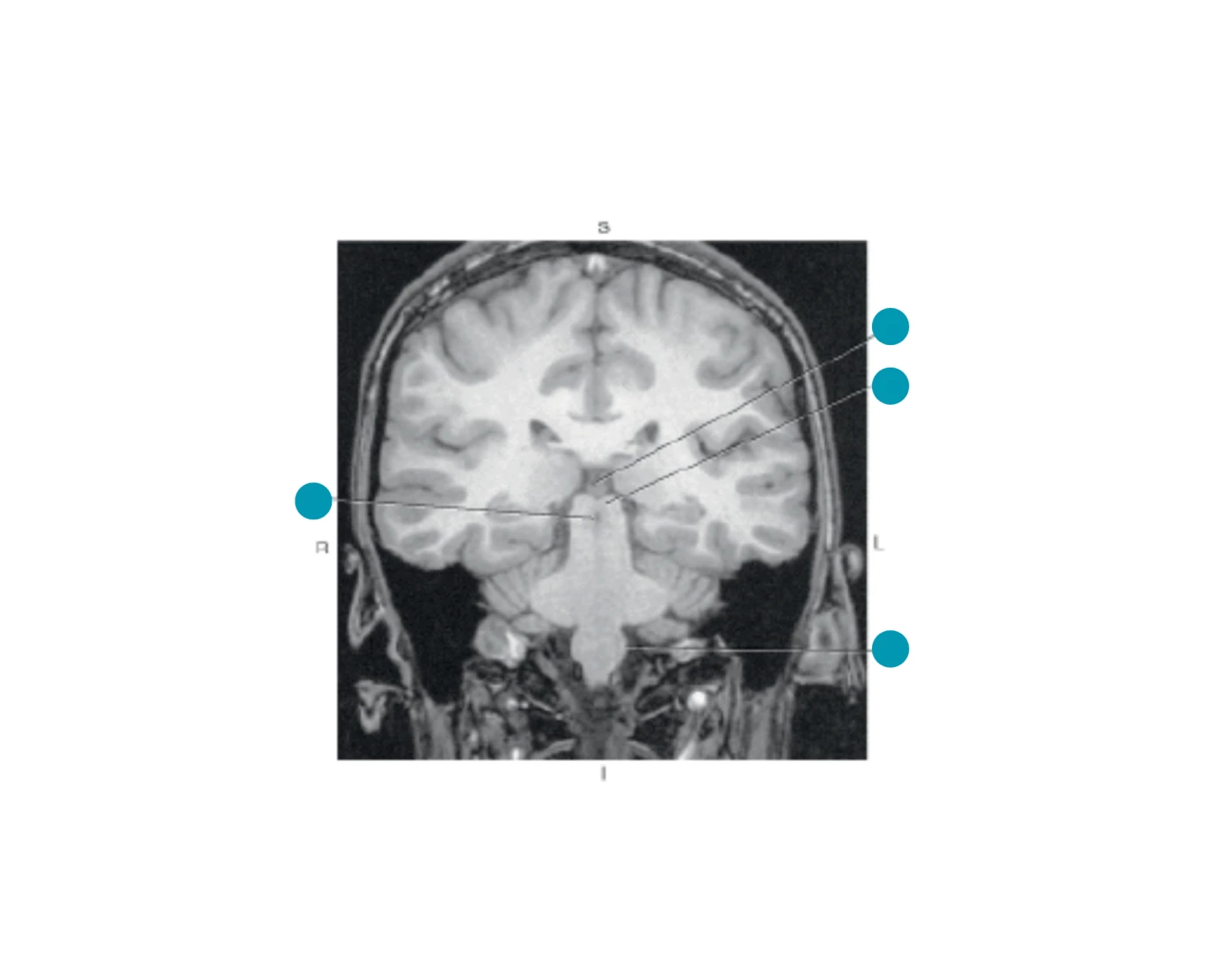 Coronal Brain-MRI Quiz