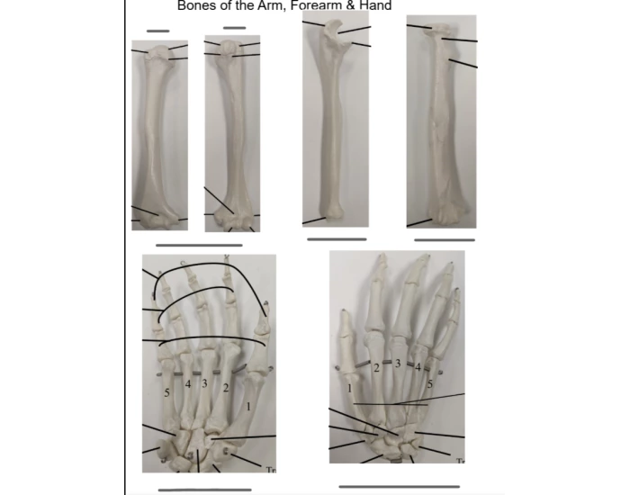 Bones of the Arm, Forearm, and Hand Quiz