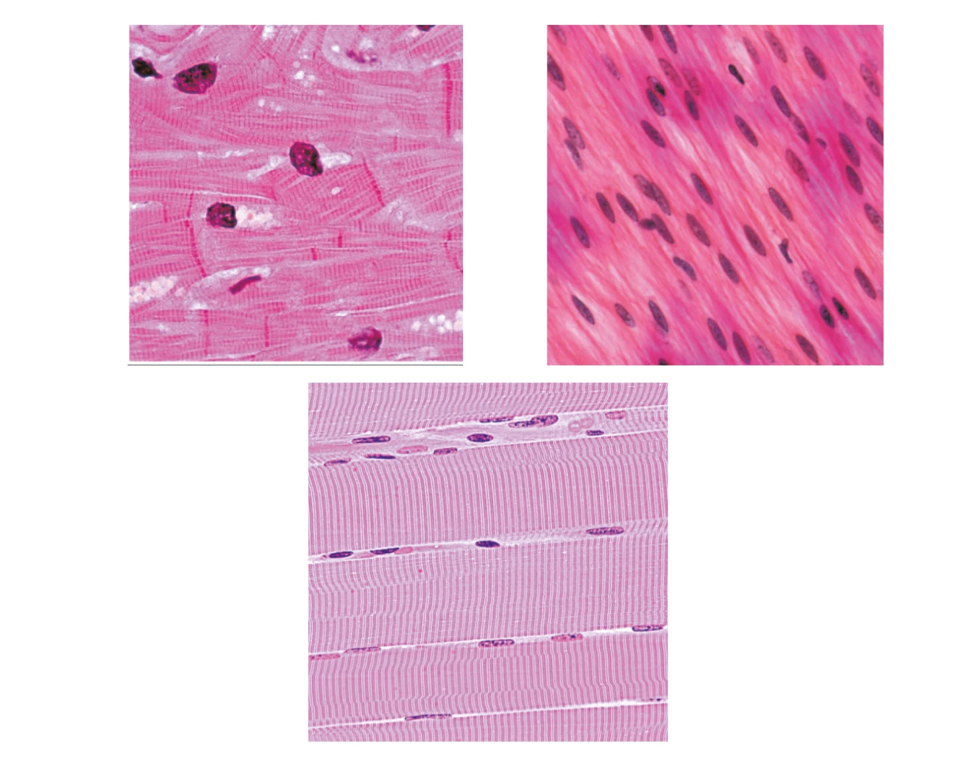 Muschle Muscle Histology - Skeletal, Cardiac, Smooth — Printable Worksheet