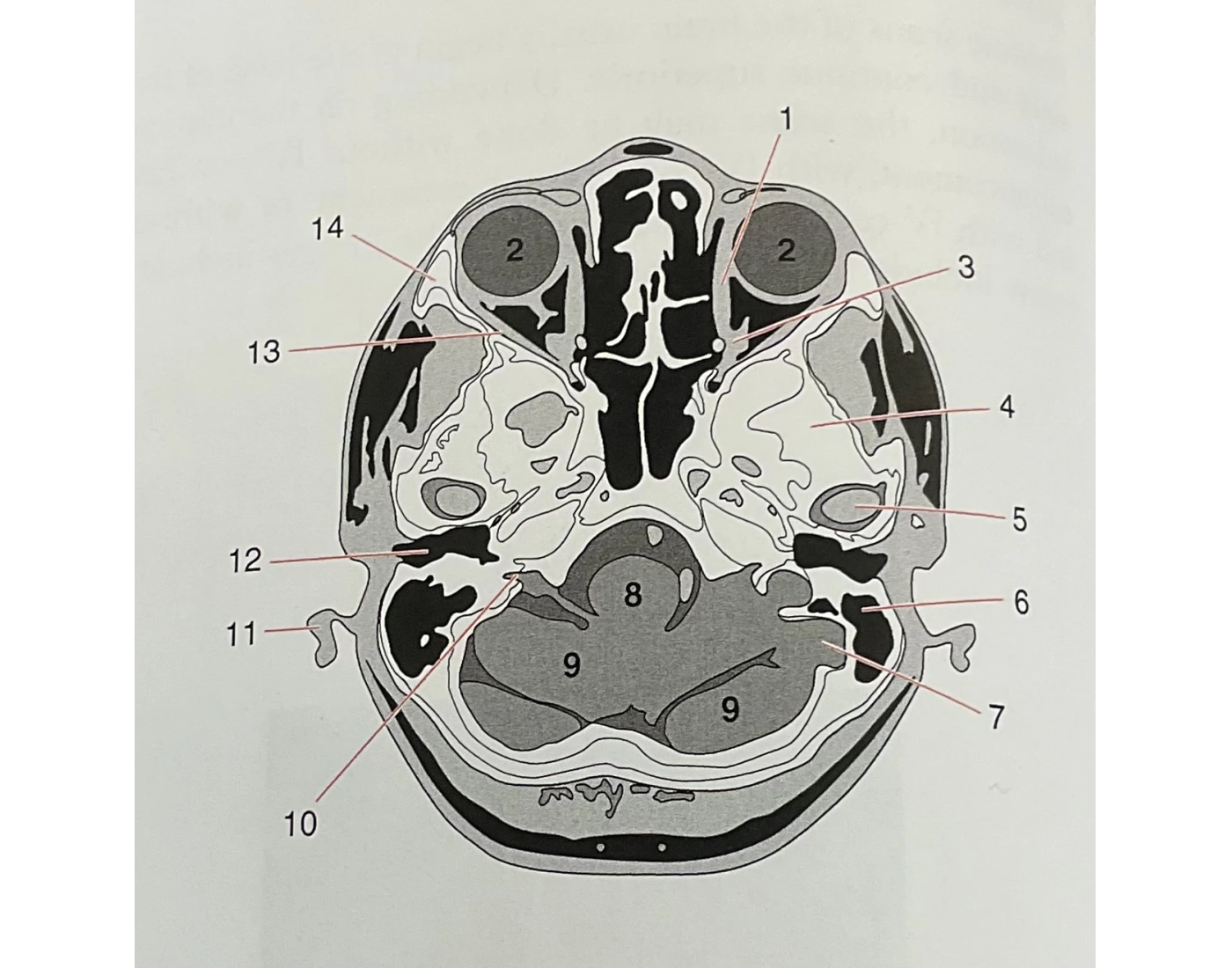 Cs Brain Function 2. Brain CS anatomy Quiz