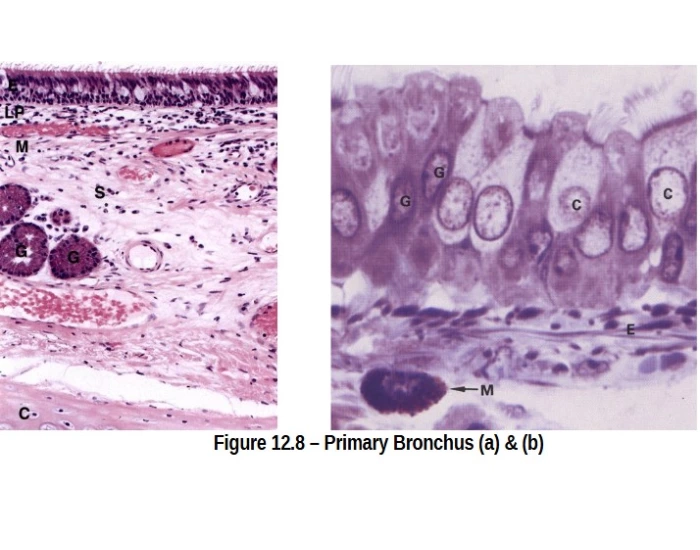 Primary Bronchi Microscope Primary Bronchus Quiz