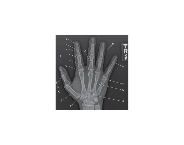 Hand Annotation X Ray Hand X-ray Labeling Quiz