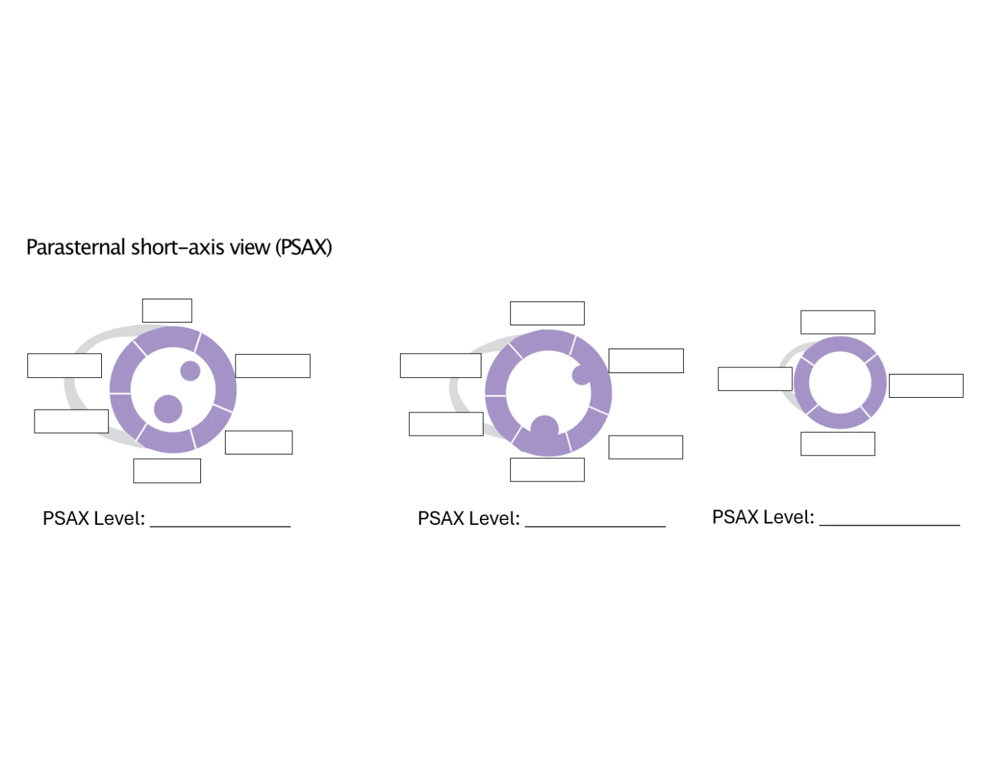 Psax Labels Echo LV Wall Segments - PSAX Window Quiz