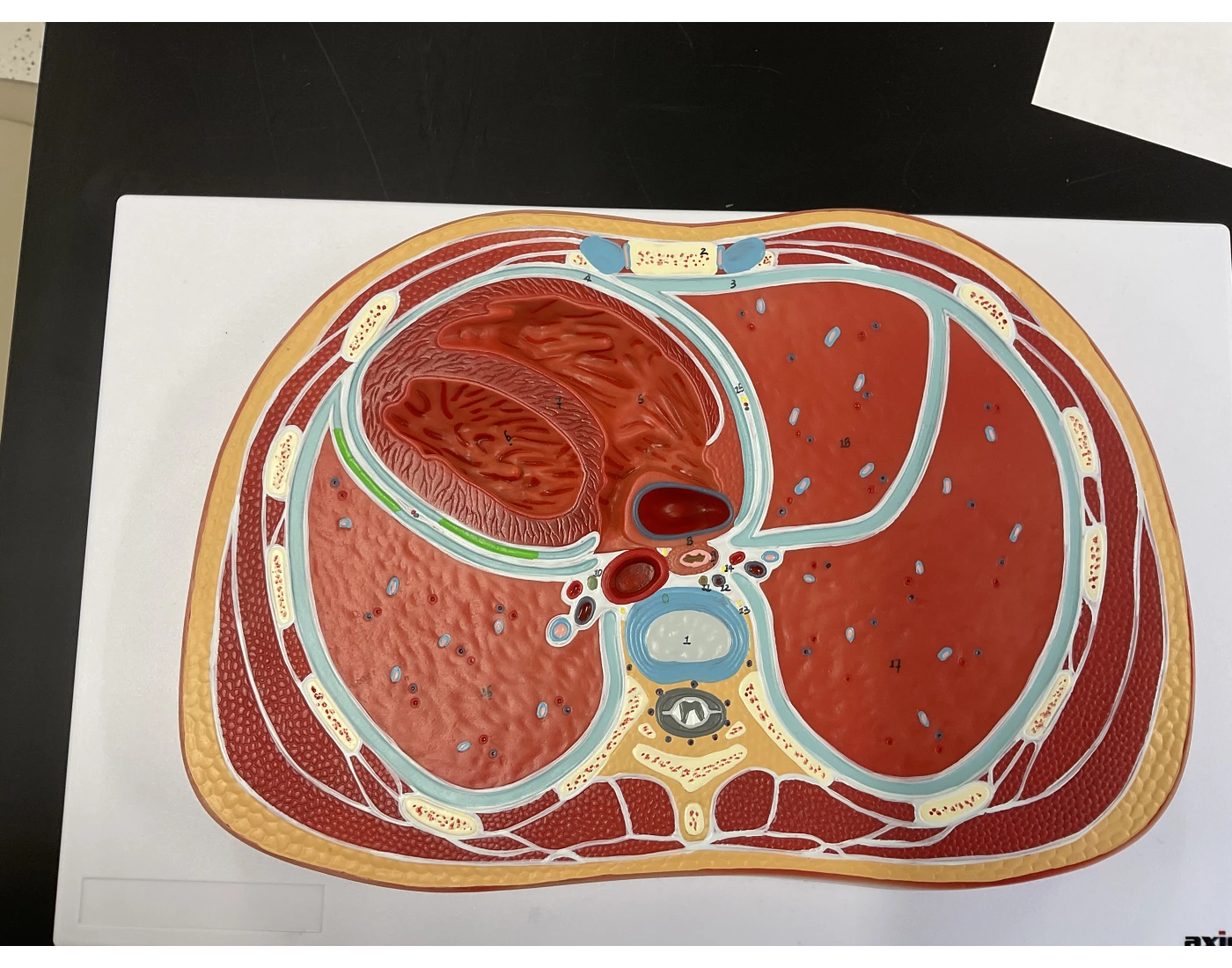 Cross Section Lab Model BIOL 221 Lab 1: Thoracic Cross Section Quiz