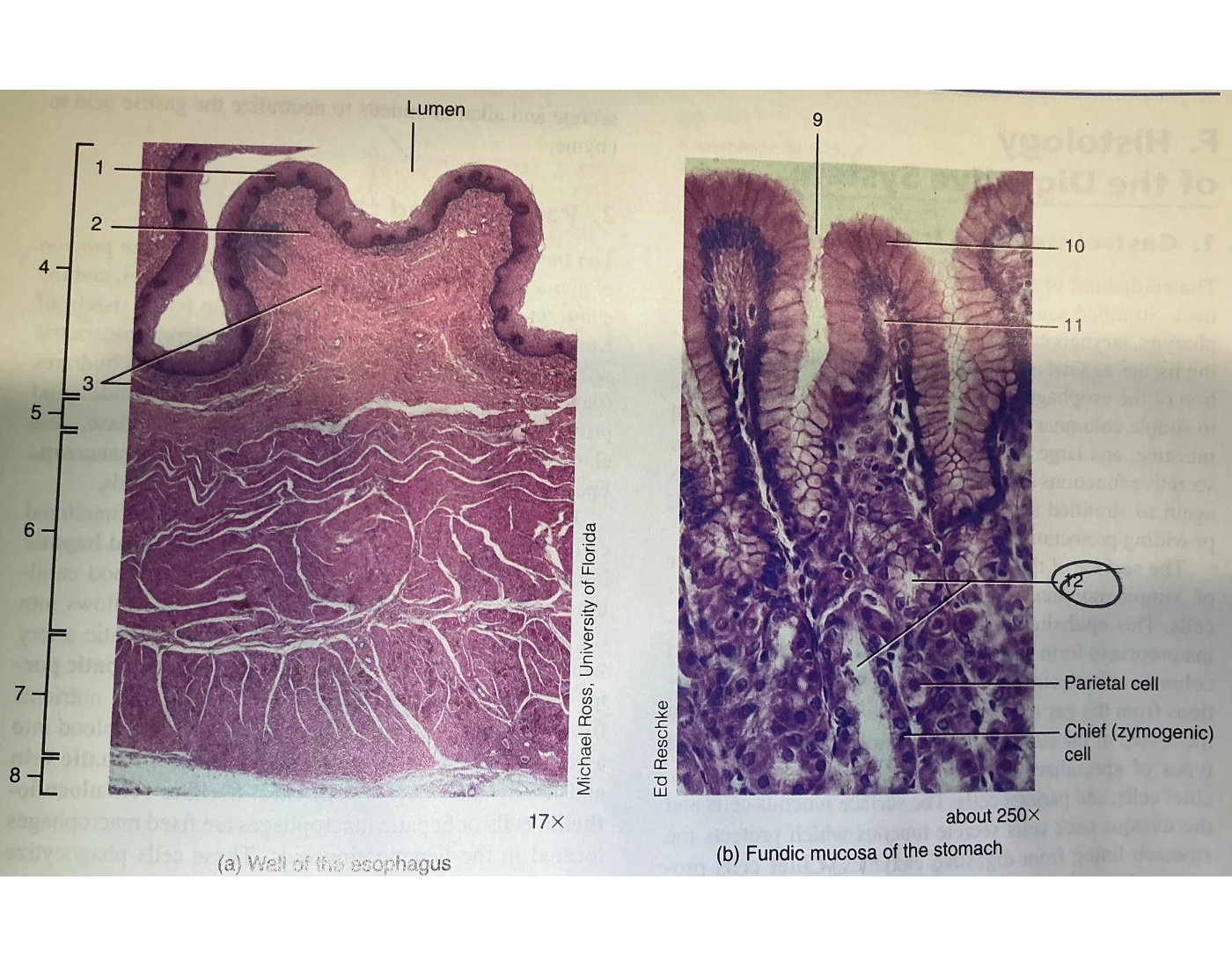 Fundic Gas Wall of esophagus and fundic mucosa of the stomach Quiz