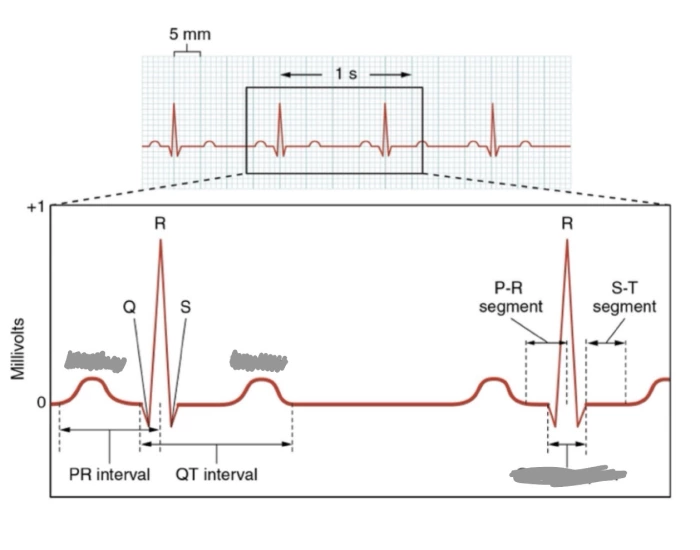Electrocardiogram (ECG or EKG) Quiz