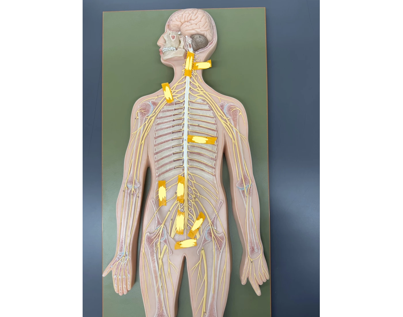 Spinal Nerve and Nerve Plexus Model Quiz