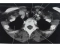 Earth Rotation Adding Day CT Neck anatomy Axial view 3 Quiz