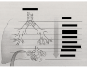 Respirometer Graph Labeled Label the Spirometry Graph Quiz